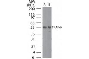 Western Blotting (WB) image for anti-TNF Receptor-Associated Factor 6 (TRAF6) (AA 436-449) antibody (ABIN208879) (TRAF6 Antikörper  (AA 436-449))