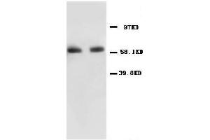 Anti-NF-kB p65 antibody, Western blottingAll lanes: Anti NF-kB p65  at 0. (NF-kB p65 Antikörper  (N-Term))