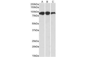 AP21267PU-N ACO2 Antibody staining of Human (A), Mouse (B) and Rat (C) Adipose lysates at 0. (ACO2 Antikörper  (Internal Region))