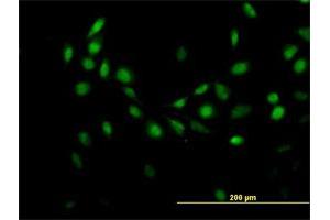 Immunofluorescence of purified MaxPab antibody to C7orf16 on HeLa cell.
