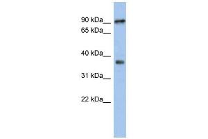 RSPH10B antibody used at 1 ug/ml to detect target protein. (RSPH10B Antikörper)