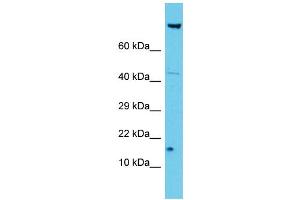 Host: Rabbit Target Name: NDUFA12 Sample Type: Jurkat Whole Cell lysates Antibody Dilution: 1. (NDUFA12 Antikörper  (N-Term))