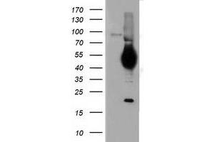 HEK293T cells were transfected with the pCMV6-ENTRY control (Left lane) or pCMV6-ENTRY CD5 (Right lane) cDNA for 48 hrs and lysed. (CD5 Antikörper)