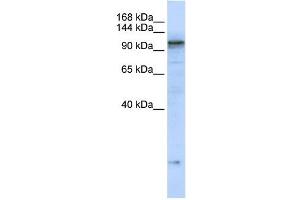 ATP2A2 antibody used at 1 ug/ml to detect target protein. (ATP2A2 Antikörper  (C-Term))