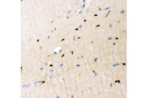 IHC analysis of Crk p38 using anti-Crk p38 antibody (ABIN3042758).