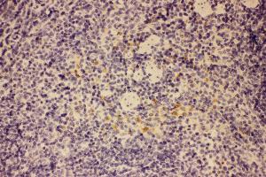 Anti-GM-CSF Picoband antibody,  IHC(P): Mouse Spleen Tissue