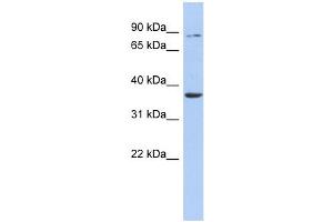 HS3ST1 antibody used at 1 ug/ml to detect target protein. (HS3ST1 Antikörper)