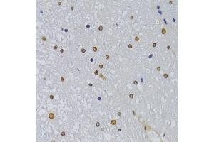 Immunohistochemistry of paraffin-embedded rat spinal cord using HNRNPA1 Antibody (ABIN5975570) at dilution of 1/100 (40x lens). (HNRNPA1 Antikörper)