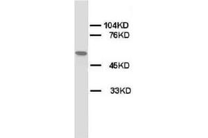 Western blot on Rat skeletal muscle lysis using AP23320PU-N CHRNA1 antibody. (CHRNA1 Antikörper  (N-Term, Subunit alpha))
