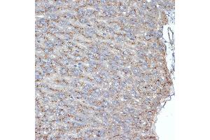 Immunohistochemistry of paraffin-embedded mouse liver using SR-B2/SR-B2/LIMPII Rabbit mAb (ABIN7270157) at dilution of 1:100 (40x lens). (SCARB2 Antikörper)