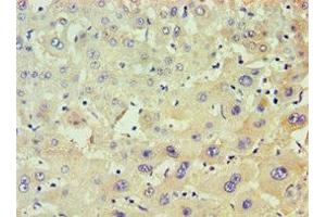 Immunohistochemistry of paraffin-embedded human liver tissue using ABIN7150482 at dilution of 1:100 (POLR1D Antikörper  (AA 1-133))