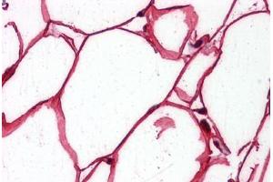 Human Adipocytes: Formalin-Fixed, Paraffin-Embedded (FFPE) (SHC1 Antikörper  (AA 171-280))