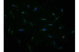 Immunofluorescence staining of U251 cells with ABIN7167254 at 1:100, counter-stained with DAPI. (RAB23 Antikörper  (AA 18-234))