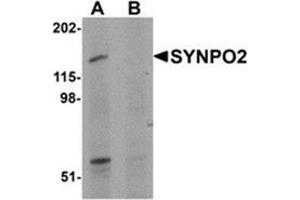 Western blot analysis of SYNPO2 in human skeletal muscle tissue lysate with SYNPO2 antibody at 1 μg/ml in (A) the absence and (B) the presence of blocking peptide.