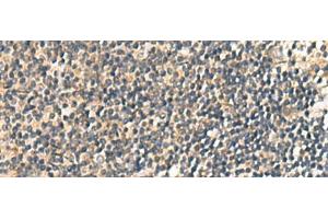 Immunohistochemistry of paraffin-embedded Human tonsil tissue using CNST Polyclonal Antibody at dilution of 1:60(x200)