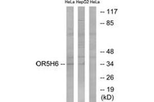 Western blot analysis of extracts from HeLa/HepG2 cells, using OR5H6 Antibody. (OR5H6 Antikörper  (AA 215-264))