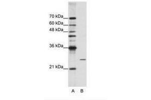 Image no. 2 for anti-Processing of Precursor 4, Ribonuclease P/MRP Subunit (POP4) (C-Term) antibody (ABIN202077)