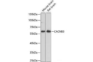 Western blot analysis of extracts of various cell lines using CACNB3 Polyclonal Antibody at dilution of 1:1000. (CACNB3 Antikörper)