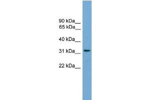 Human COLO205; WB Suggested Anti-CCDC117 Antibody Titration: 0. (CCDC117 Antikörper  (C-Term))