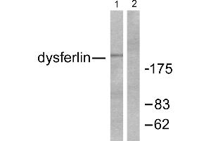 Western blot analysis of extracts from K562 cells, using Dysferlin antibody. (Dysferlin Antikörper)