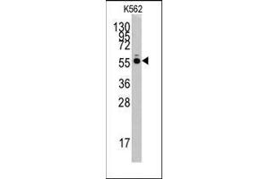 Western blot analysis of anti-HARS Pab in K562 cell line lysates (35ug/lane). (HARS1/Jo-1 Antikörper  (N-Term))