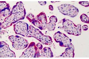 Human Placenta: Formalin-Fixed, Paraffin-Embedded (FFPE) (ADAM12 Antikörper  (AA 2-14))