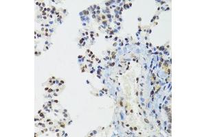 Immunohistochemistry of paraffin-embedded mouse lung using BAZ1B antibody. (BAZ1B Antikörper  (AA 1-260))