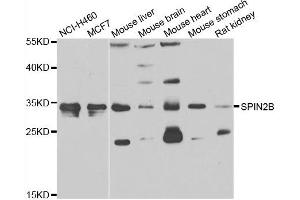 Western blot analysis of extracts of various cell lines, using SPIN2B antibody. (Spindlin 2B Antikörper)