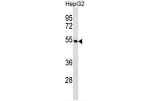 KRT26 Antibody (N-term) western blot analysis in HepG2 cell line lysates (35µg/lane). (Keratin 26 Antikörper  (N-Term))