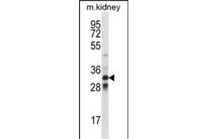 TLX1 Antibody (Center) (ABIN656421 and ABIN2845712) western blot analysis in mouse kidney tissue lysates (35 μg/lane). (TLX1 Antikörper  (AA 163-191))