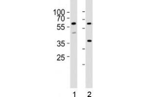 Western blot analysis of lysate from 1) HT-29 and 2) K562 cell lines using RIPK3 antibody at 1:1000.