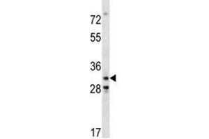 Cdk4 antibody western blot analysis in mouse NIH3T3 lysate. (CDK4 Antikörper  (AA 219-246))