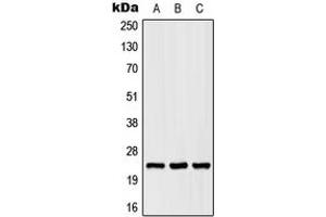 Western blot analysis of SCN2B expression in HEK293T (A), Raw264.