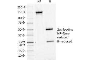 SDS-PAGE Analysis Purified bcl-6 Mouse Monoclonal Antibody (BCL6/1475). (BCL6 Antikörper  (AA 256-389))