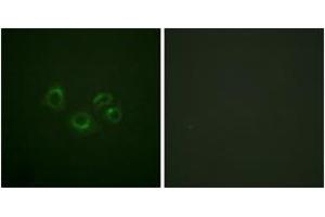 Immunofluorescence analysis of A549 cells, using EPHA2/3/4 (Ab-588/596) Antibody. (EPHA2/3/4 Antikörper  (AA 556-605))