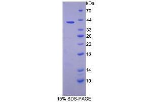SDS-PAGE analysis of Human PSMD7 Protein. (PSMD7 Protein)