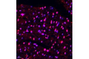 Immunofluorescence of paraffin embedded mouse heart using DGKI (ABIN7073721) at dilution of 1:650 (400x lens) (DGKI Antikörper)