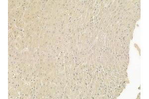 ABIN6266026 and ABIN6277560 at 1/100 staining human normal liver tissue by IHC-P. (WIF1 Antikörper  (Internal Region))