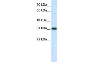 Western Blotting (WB) image for anti-Nuclear Receptor Interacting Protein 2 (NRIP2) antibody (ABIN2461500) (NRIP2 Antikörper)