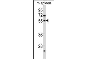 DOK7 Antibody (N-term) (ABIN657491 and ABIN2846518) western blot analysis in mouse spleen tissue lysates (35 μg/lane). (DOK7 Antikörper  (N-Term))