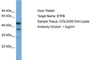 Host: Rabbit Target Name: ETFB Sample Tissue: Human COLO205 Whole Cell Antibody Dilution: 1ug/ml (ETFB Antikörper  (C-Term))