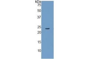 WB of Protein Standard: different control antibodies against Highly purified E. (RBP4 ELISA Kit)