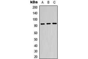 Western blot analysis of Beta-glucuronidase expression in K562 (A), HeLa (B), HepG2 (C) whole cell lysates. (Glucuronidase beta Antikörper  (Center))