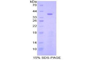 SDS-PAGE analysis of Mouse STAP1 Protein.