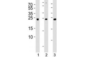 Western blot analysis of lysate from 1) 293, 2) SW620, and 3) U-87 MG cell line using UCHL3 antibody at 1:1000.
