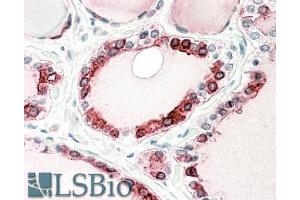 ABIN768643 (5µg/ml) staining of paraffin embedded Human Thyroid Gland. (Thyroperoxidase Antikörper  (C-Term))