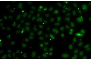 Immunofluorescence analysis of A549 cells using NSL1 Polyclonal Antibody (NSL1 Antikörper)