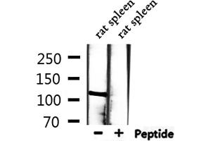 Western blot analysis of extracts from rat spleen, using MCM2 Antibody. (MCM2 Antikörper  (N-Term))