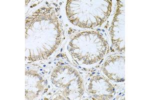 Immunohistochemistry of paraffin-embedded human stomach using HPS1 antibody at dilution of 1:100 (x40 lens). (HPS1 Antikörper)