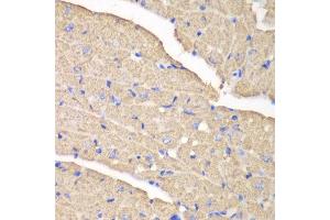 Immunohistochemistry of paraffin-embedded mouse heart using VDAC1 antibody at dilution of 1:100 (400x lens).